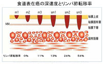 食道表在癌の進達度とリンパ節転移率